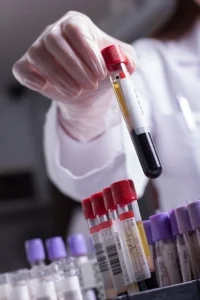 Using Flow Cytometry to Monitor Exhaustion