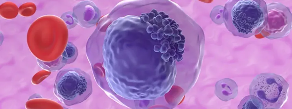 FLT3 Inhibitors in AML – Understanding Therapy Resistance