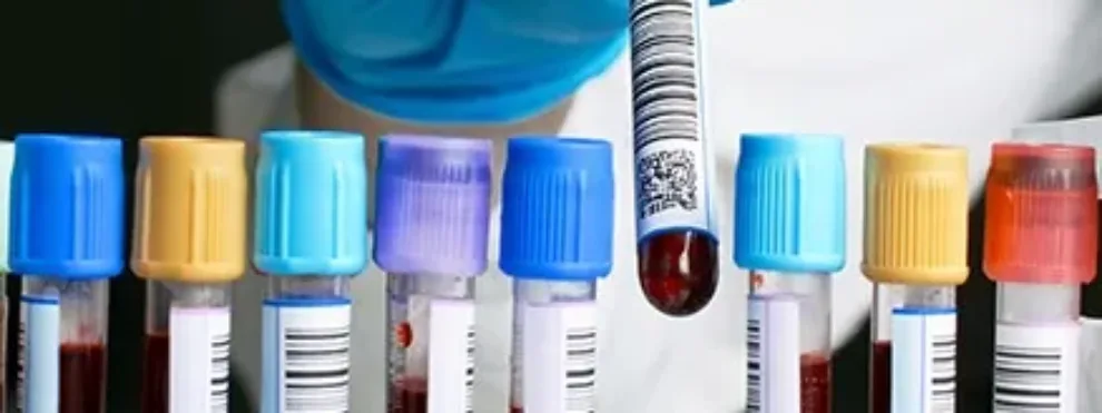 Developing Clinical Flow Cytometry Assays