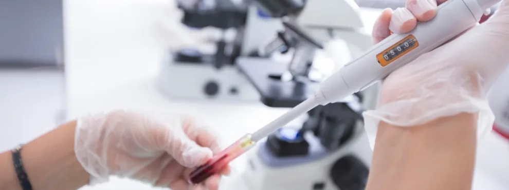 Evaluating Memory T Cells in Clinical Settings