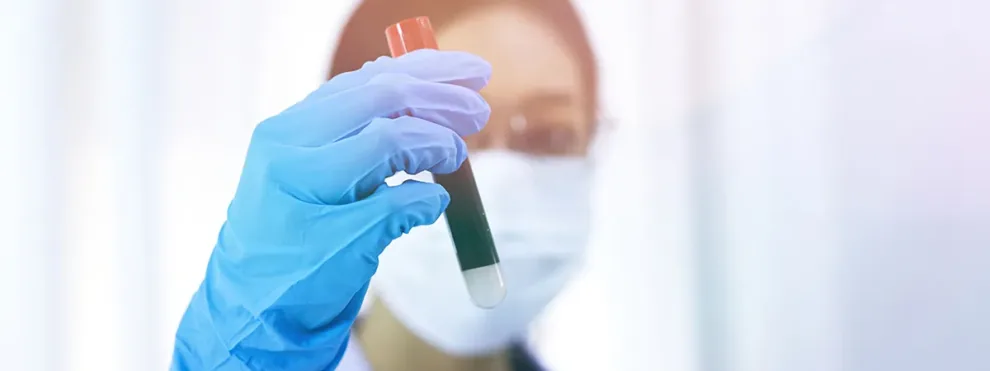Why Sample Collection Matters in Clinical Flow Cytometry