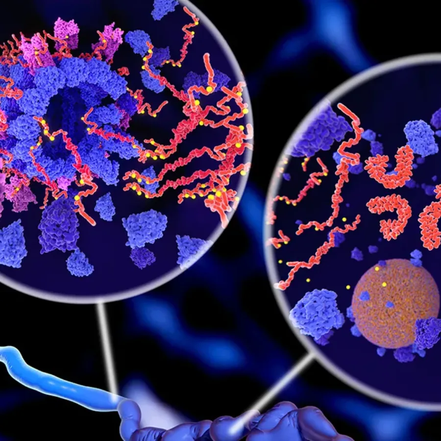 Alzheimer: Phosphorylation of Tau proteins leads to disintegration of microtubuli in a neuron axon