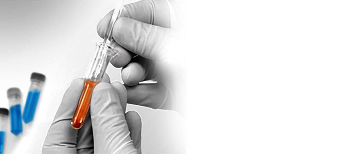 Non-Liquid Matrices Bioanalysis: Assessing PD & PK | KCAS Bio