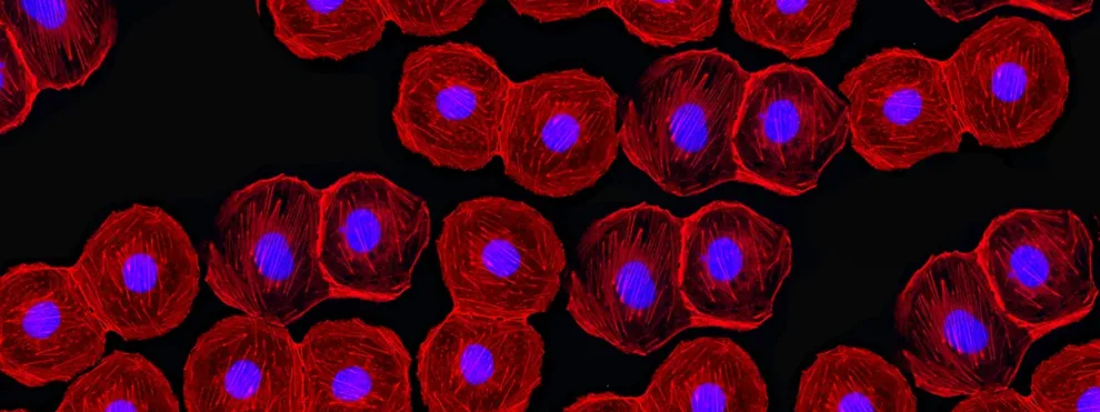 Sorting out the Details: Three Factors to Consider for Cell Sorting by Flow Cytometry