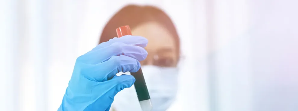 Good Clinical Flow Cytometry Starts with Sample Collection