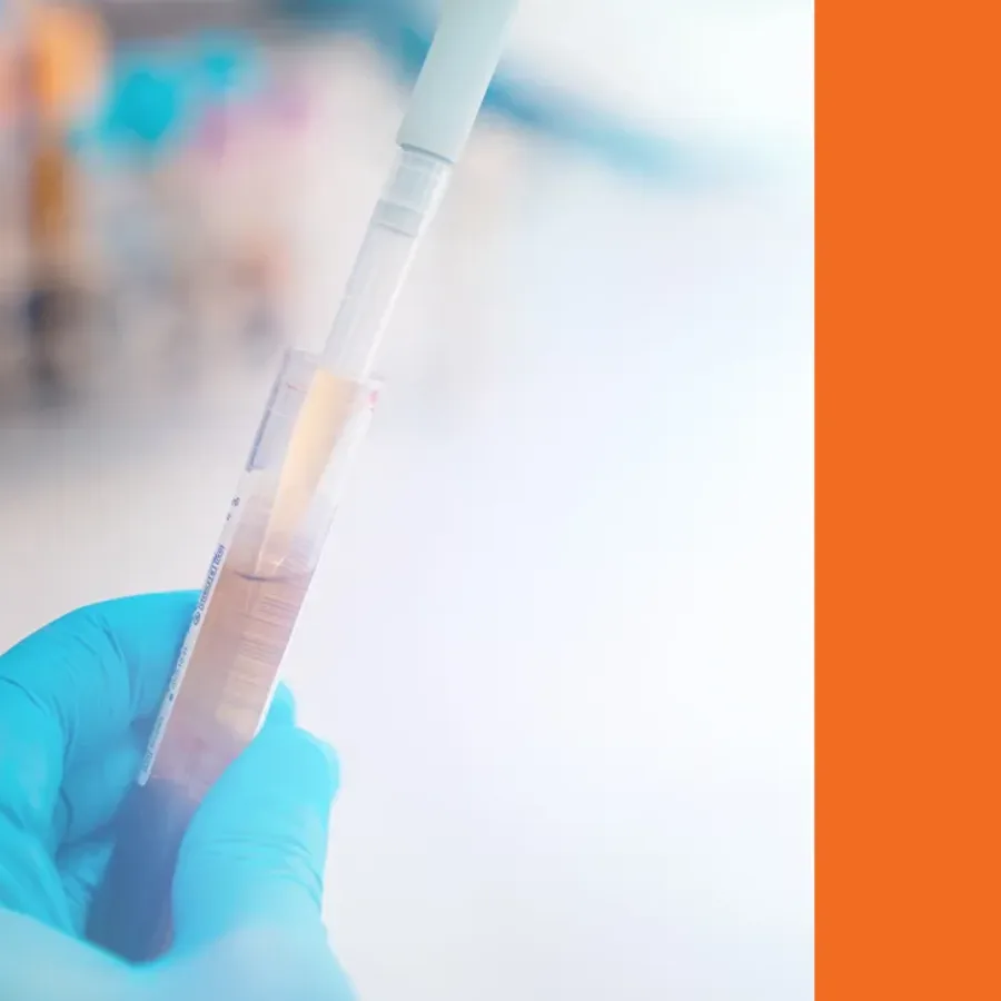 Choosing the Right Sample Matrix for Flow Cytometry: A Quick-reference guide for scientists and clinical study planners