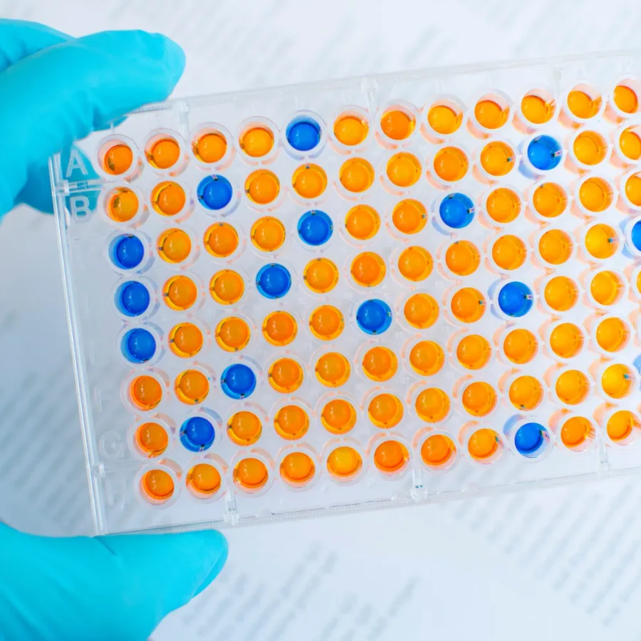 Enzyme-linked immunosorbent assay (ELISA), Immunology testing method in laboratory